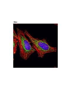 Cell Signaling Succinyl-Coa Synthetase (D8a11) Rabbit mAb