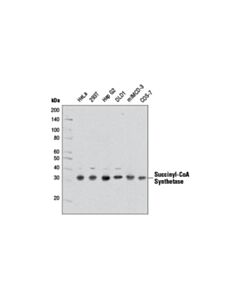 Cell Signaling Succinyl-CoA Synthetase (D8A11) Rabbit mAb 20 uL