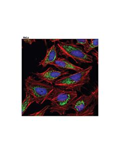 Cell Signaling Tfam (D5c8) Rabbit mAb