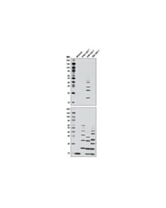 Cell Signaling K48-Linkage Specific Polyubiquitin (D9d5) Rabbit mAb
