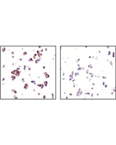Cell Signaling Signalslide Phospho-Akt (Ser473) Ihc Controls
