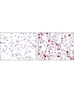 Cell Signaling Signalslide Phospho-Egf Receptor Ihc Controls