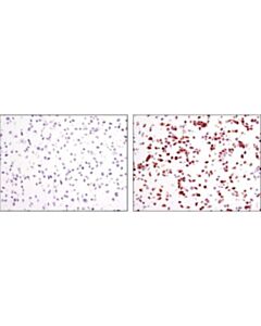 Cell Signaling Signalslide Phospho-P44/42 Mapk (Thr202/Tyr204) Ihc Controls