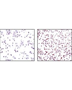 Cell Signaling Signalslide Pten Ihc Controls