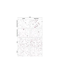 Cell Signaling Signalstain Proliferation/Apoptosis Ihc Sampler Kit