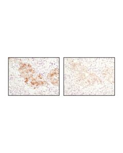 Cell Signaling Signalstain Antibody Diluent
