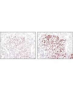 Cell Signaling Signalstain Boost Ihc Detection Reagent (Hrp, Rabbit)