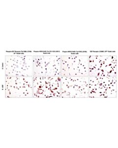Cell Signaling Signalslide Phospho-Erbb Family Ihc Controls
