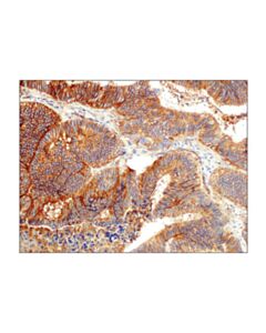 Cell Signaling Pvr/Cd155 (D8a5g) Rabbit mAb