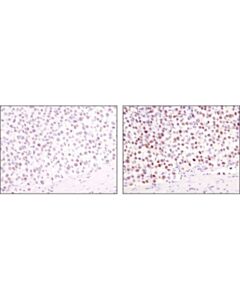 Cell Signaling Signalstain Boost Ihc Detection Reagent (Hrp, Mouse)