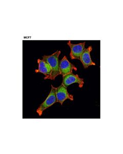 Cell Signaling Rab10 (D36c4) Xp Rabbit mAb