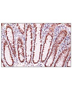 Cell Signaling Adar1 (E6x9r) Xp Rabbit mAb