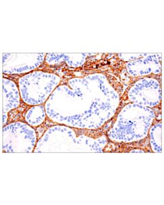 Cell Signaling Col1a1 (E8f4l) Xp® Rabbit mAb (BSA And Azide Free)