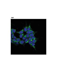 Cell Signaling Idh1 (D2h1) Rabbit mAb