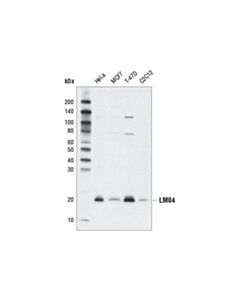 Cell Signaling Lmo4 (D6v4z) Rabbit mAb