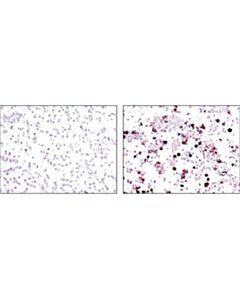 Cell Signaling Dykddddk Tag (9a3) Mouse mAb (Binds To Same Epitope As Sigmas Anti-Flag M2 Antibody)
