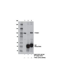 Cell Signaling Ythdc1 (E2p2i) Rabbit mAb