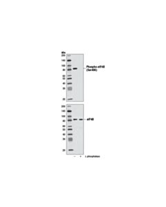 Cell Signaling Phospho-Eif4b (Ser406) (D1c10) Rabbit mAb
