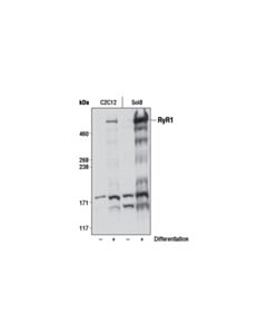 Cell Signaling RyR1 (D4E1) Rabbit mAb 20 uL