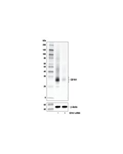 Cell Signaling CD151 (E9M8T) Rabbit mAb 20 uL