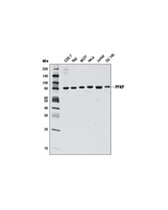 Cell Signaling Pfkp (D4b2) Rabbit mAb