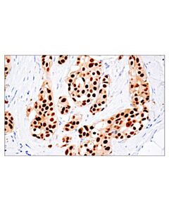 Cell Signaling Mage-A10 (E9v2q) Rabbit mAb