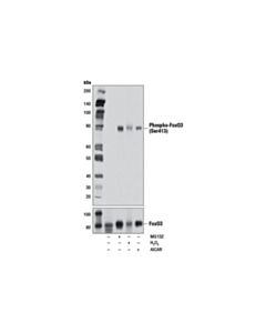 Cell Signaling Phospho-FoxO3a (Ser413) (D77C9) Rabbit mAb 20 uL