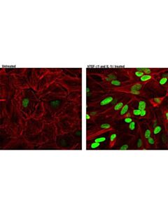 Cell Signaling Hmga2 (D1a7) Rabbit mAb