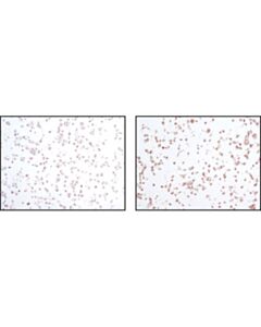 Cell Signaling Phosphoplus Sapk/Jnk (Thr183/Tyr185) Antibody Duet