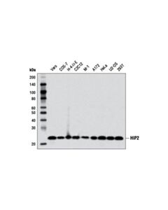 Cell Signaling Hip2 (D27c4) Rabbit mAb
