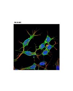Cell Signaling P75ntr (D4b3) Xp Rabbit mAb