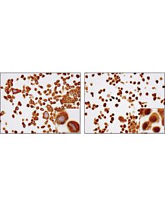 Cell Signaling Nf-Kappab P65 (D14e12) Xp Rabbit mAb
