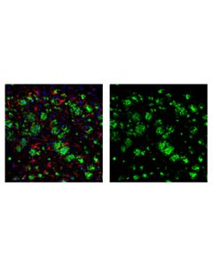 Cell Signaling Beta-Amyloid (D54d2) Xp Rabbit mAb