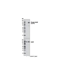 Cell Signaling Phospho-Epha2 (Tyr772) Antibody