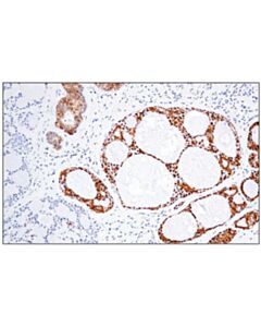 Cell Signaling Mage-A4 (E7o1u) Xp Rabbit mAb