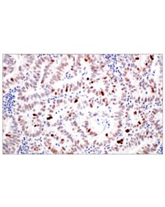 Cell Signaling MDM2 (F7W7X) Rabbit mAb