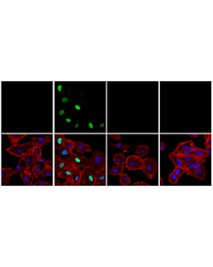 Cell Signaling Phospho-P53 (Ser15) (E9y4u) Rabbit mAb
