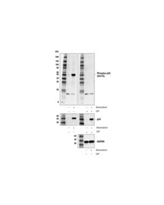 Cell Signaling Phospho-p53 (Ser15) (E9Y4U) Rabbit mAb 20 uL