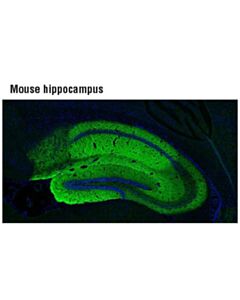 Cell Signaling Silent Synapses Antibody Sampler Kit