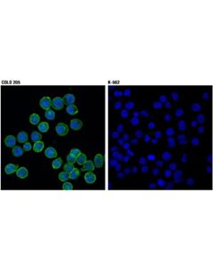 Cell Signaling Ephb2 (D2x2i) Rabbit mAb