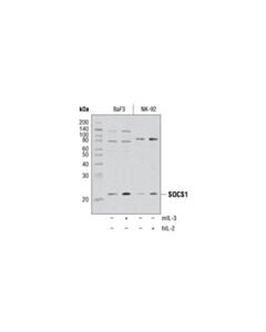 Cell Signaling Jak/Stat Pathway Inhibitors Antibody Sampler Kit