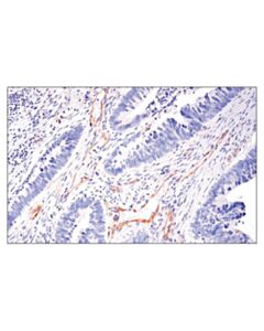Cell Signaling Lc3b (E5q2k) Mouse mAb