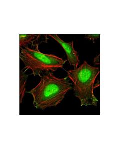 Cell Signaling Cofilin Activation Antibody Sampler Kit