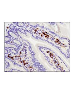 Cell Signaling Tim-3 (D3m9r) Xp Rabbit mAb (Mouse Specific)