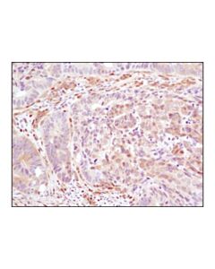 Cell Signaling Yap/Taz (D24e4) Rabbit mAb