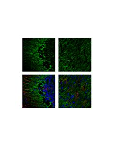 Cell Signaling Neurofilament-M Antibody
