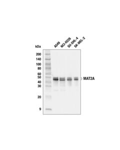 Cell Signaling Mat2a (E5i7c) Rabbit mAb