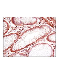 Cell Signaling Pan-Actin (D18c11) Rabbit mAb