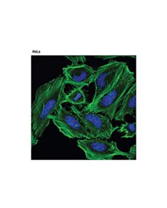 Cell Signaling Beta-Actin (D6a8) Rabbit mAb