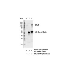 Cell Signaling Cyld (D1a10) Rabbit mAb